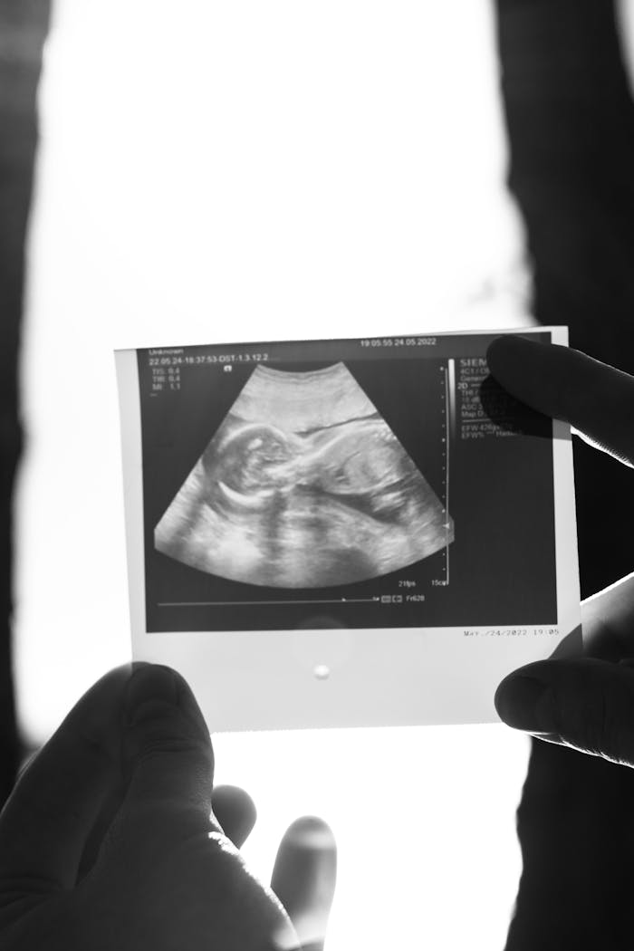 Black and white close-up of a pregnancy ultrasound sonogram held by hands.