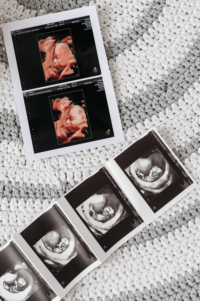 services-04 Close-up ultrasound images showing prenatal development on textured background.