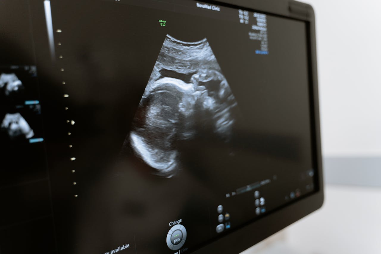 gallery-4 Close-up of an ultrasound showing a fetus on a monitor in a medical clinic.